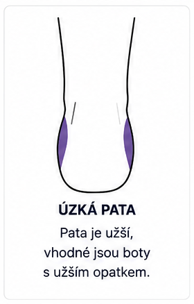 Úzká pata u dětí